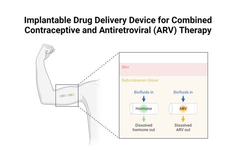 Implantable Drug Delivery Device For Antiretroviral Therapy Biorender