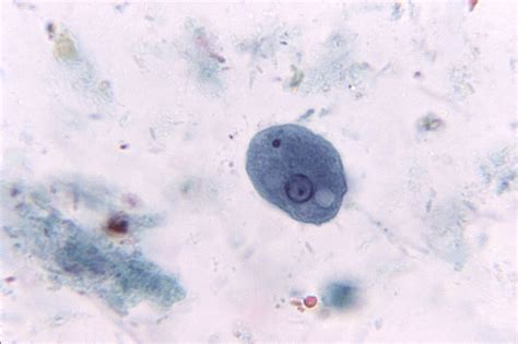 Public Domain Picture Entamoeba Coli Trophozoite With Ingested Bacteria Parasite Ameba Id