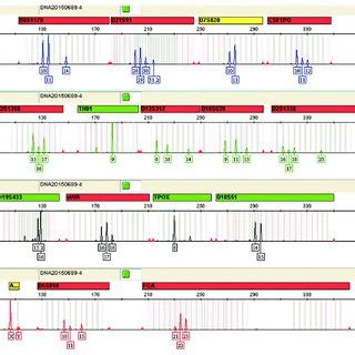 DNA Typing With The ABI Identifiler Plus Kit Of A Sample With