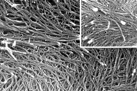 Plant Cells Under An Electron Microscope