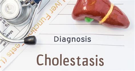 Causes and Treatments for Cholestasis - Facty Health