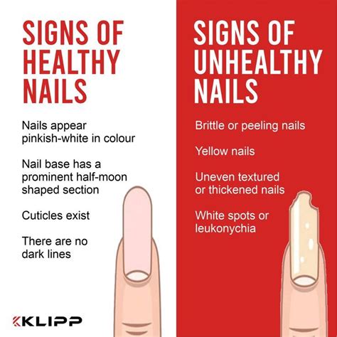 Healthy Nails Vs Unhealthy Nails