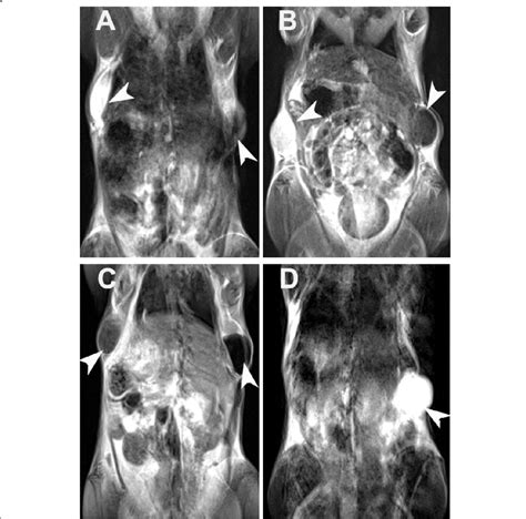 T 2 Weighted MR Images Of Different Amounts Of RAW267 4 Cell Treated