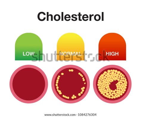 Cholesterin In Arterien Gesundheitsrisiko Vektordesign Stock