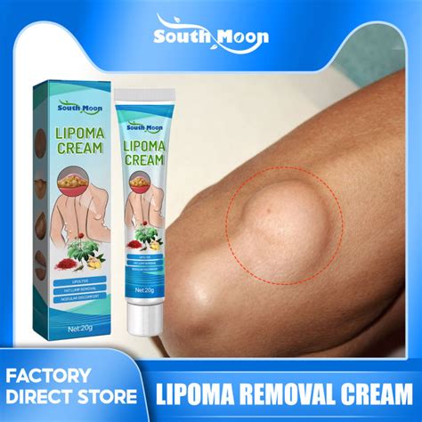 Authenticsouth Moon Lipoma Removal Cream Lipolysis Fat Lump