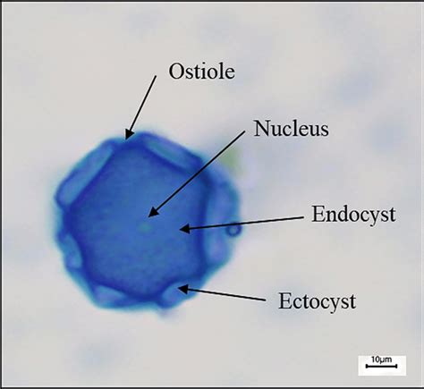 Acanthamoeba Cyst Morphology