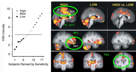Sex And Age Differences Flashcards Quizlet