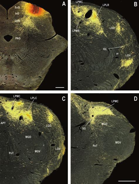 Digital Dark Field Photomicrographs Of Representative Coronal Sections