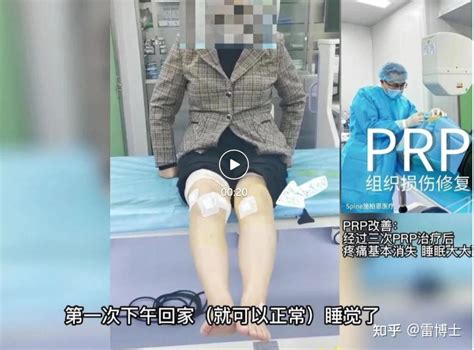 自体血可治病？明星球员们的同款“prp”你值得拥有 知乎