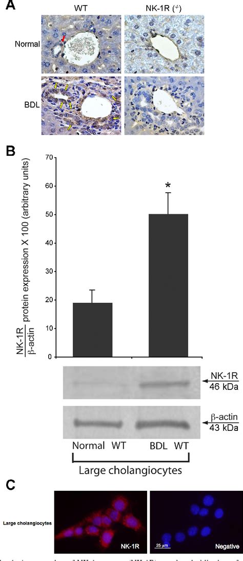 Figure From Knockout Of The Neurokinin Receptor Reduces