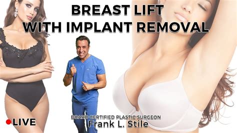 Live Breast Lift With Implant Explantation Mastopexy YouTube