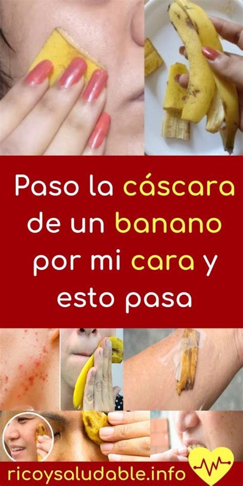 Paso La Cáscara De Un Banano Por Mi Cara Y Esto Pasa Cáscaras De Banano