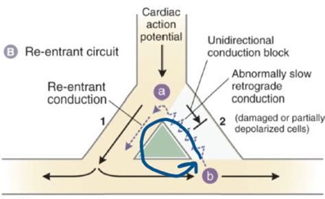 antiarrhythmic agents Flashcards | Quizlet