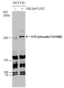 GTX128145 GeneTex ATR Antibody Antibodypedia