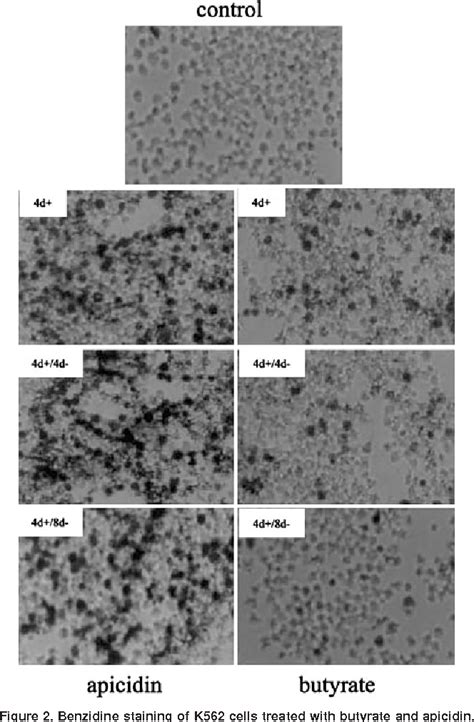 Figure From Induction Of Fetal Hemoglobin Expression By The Histone