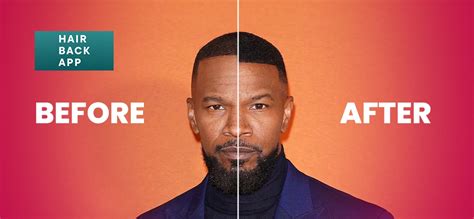 Jamie Foxx Hair Transplant Simulation