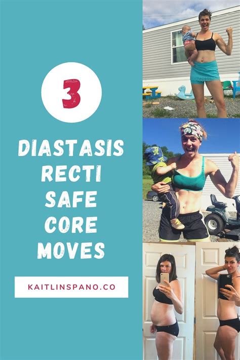 3 Core Moves That Are Diastasis Recti Safe Diastasis Recti Diastasis