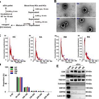Validation of small extracellular vesicles. (A) The workflow of the ... 