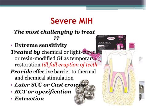 Molar Incisor Hypomineralization Ppt