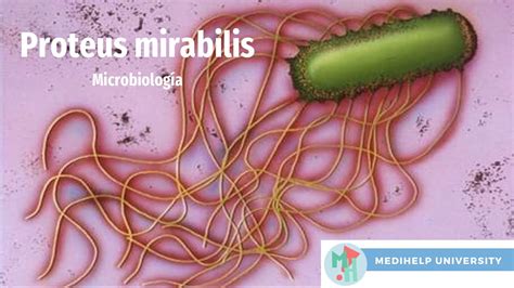 Proteus Mirabilis é Contagiosa Braincp