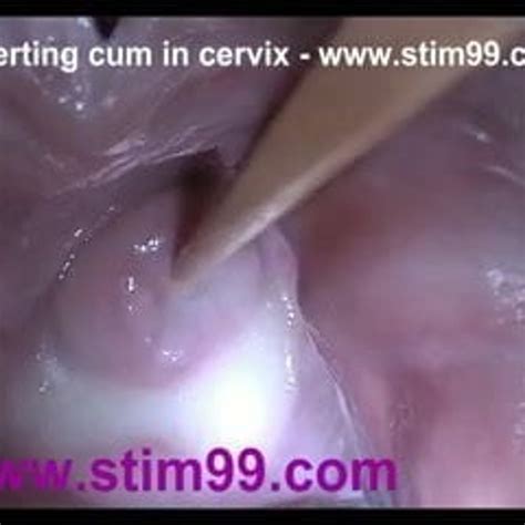 Insertion Semen Cum In Cervix Wide Stretching Pussy Speculum Xhamster