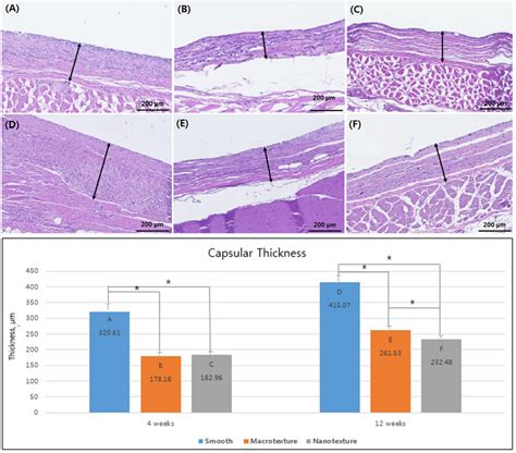 Capsule formation of the three different types of silicone implants.... | Download Scientific ...