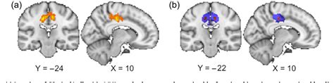 Figure 1 From Connectivity Of The Cingulate Sulcus Visual Area CSv In