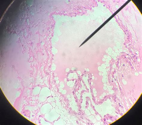 Lymph Vessel Histology.