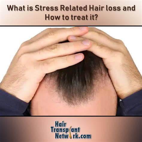 What Is Stress Related Hair Loss And How To Treat It