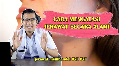 Cara Mengatasi Jerawat Secara Alami Dan Aman Untuk Kulit Dokter