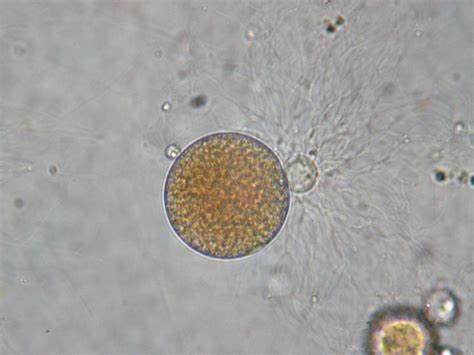 Chytridiomycota BiologÍa Y GeologÍa