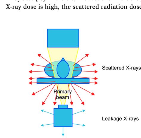 Three major causes of radiation exposure: primary X-ray beams (yellow ...