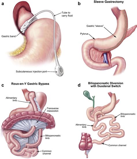 Clinical Practice Guidelines For The Perioperative Nutritional