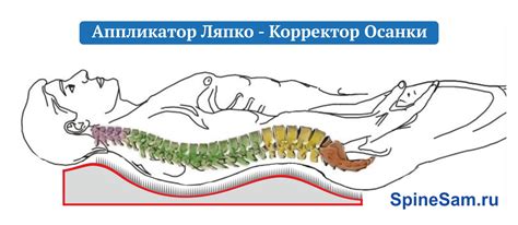 Помоги спине сам - Устройства аппликационные Ляпко