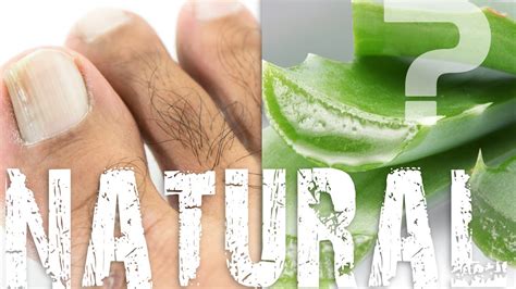 Are Natural Remedies To Treat Nail Fungus Effective Youtube