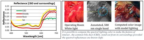 Common Bile Duct Diameter