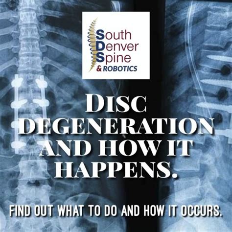 - Disc degeneration and how it happens -: South Denver Spine & Robotics ...