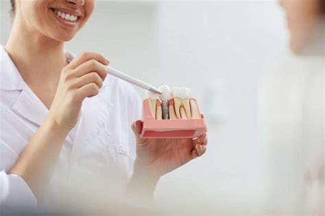 Implantes dentales: proceso paso a paso | DSS Clínica Dental