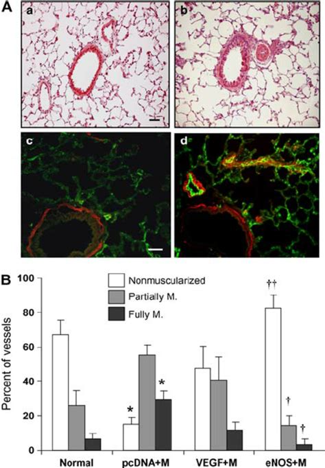 Muscularization Of Pulmonary Arterioles A Photomicro Graphs Of