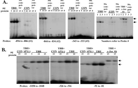 Effect Of Tbh And Dominant Negative C Jun Ap1 On Electrophoretic Download Scientific