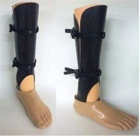 Symes Prosthesis Partial Foot Prosthesis At Rs 45000 In Surat ID