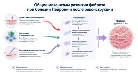 neozhidannye skhodstva  boleznyu peyroni  patsientov posle rekonstruktsii