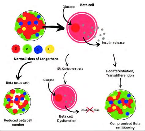 Models For Beta Cell Failure In T2D Adapted From 11 Swisa A Et