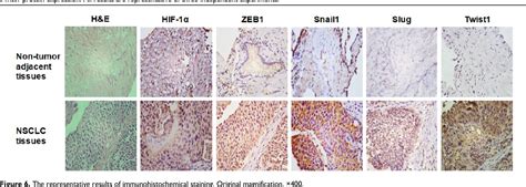 Figure 6 from PI3K Akt HIF 1α signaling pathway mediates HPV 16