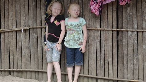 Nietos del Sol Cientos de niños albinos nacen en un pueblo aborigen de