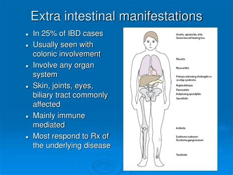 Ppt Inflammatory Bowel Disease Powerpoint Presentation Id