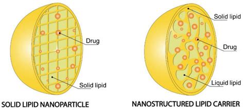 Solid Lipid Nanoparticles Vs Nanostructured Lipid Carriers