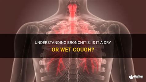 Understanding Bronchitis Is It A Dry Or Wet Cough Medshun