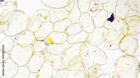 Microscopic View Of A Banana Pulp Cells Stained By Lugol Iodine