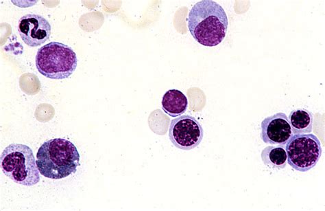 HLS Bone Marrow And Hemopoiesis Bone Marrow Smear Erythroblast